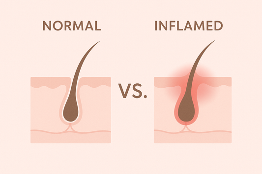 Waxing Adverse Reactions: What’s Normal, What’s Not, and When to Contact Me